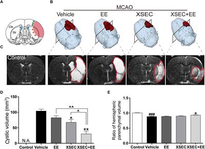 An MRI Study of Neurovascular Restorative After Combination Treatment With Xiaoshuan Enteric-Coated Capsule and Enriched Environment in Rats After Stroke